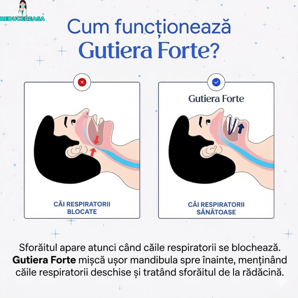 Guitera Forte Anti Sforăit - Pachet complet